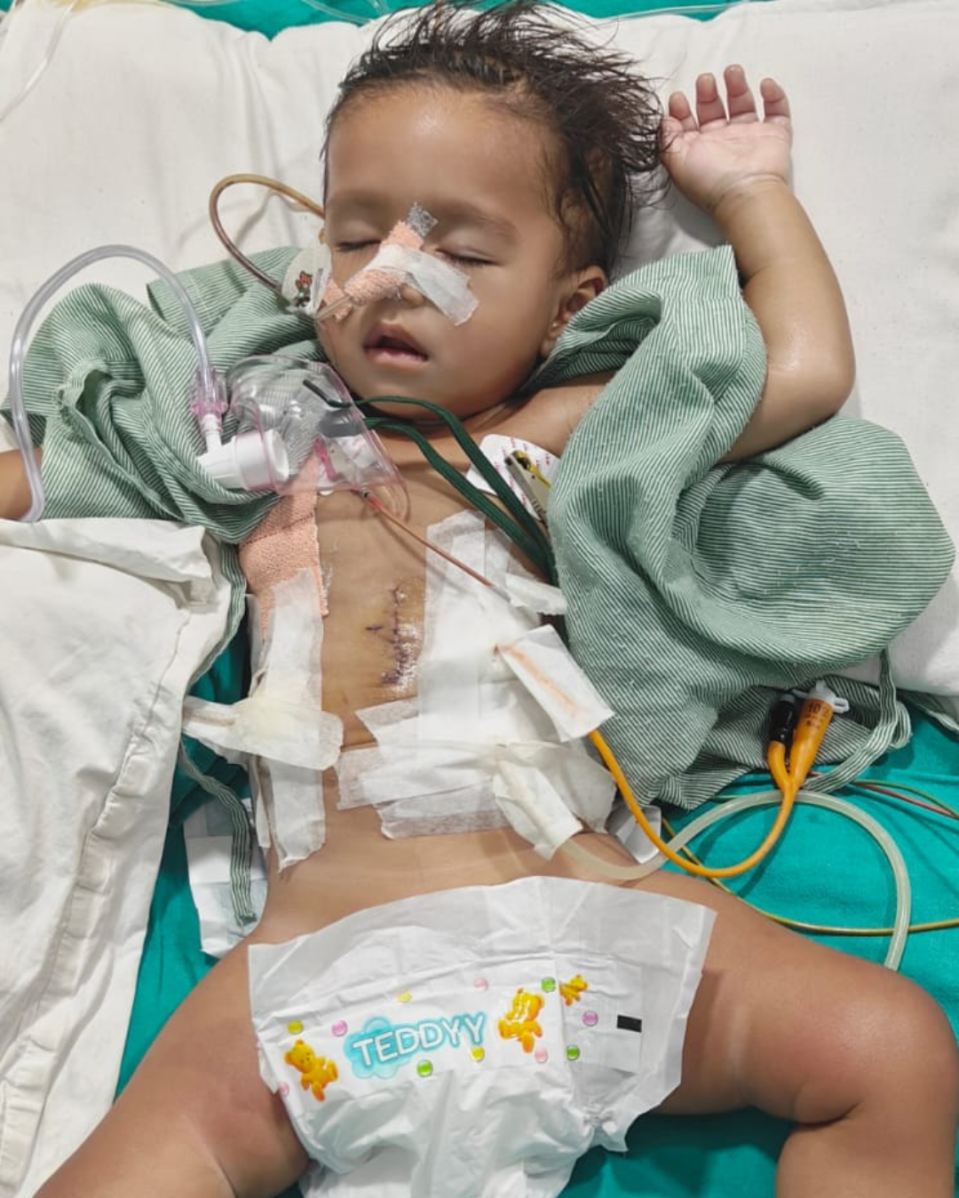 Nine-Month-Old Raghav Fights for His Life