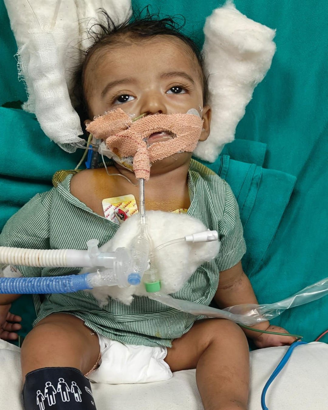 A Tiny Warrior Fighting for Life, He Needs Us Now!