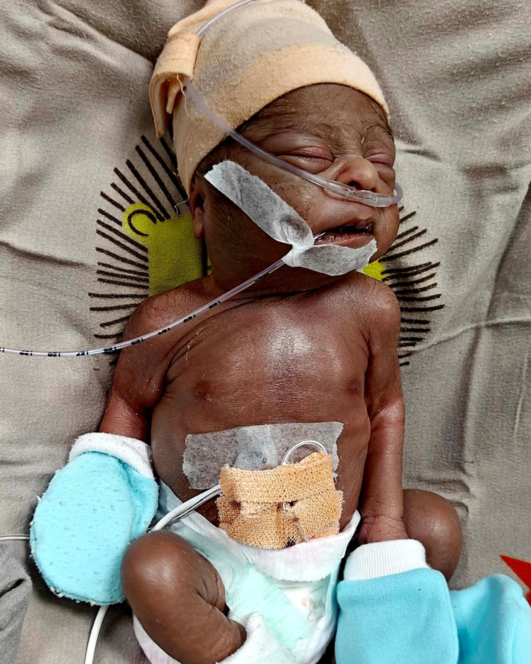 Save Baby of Nisha Gautam