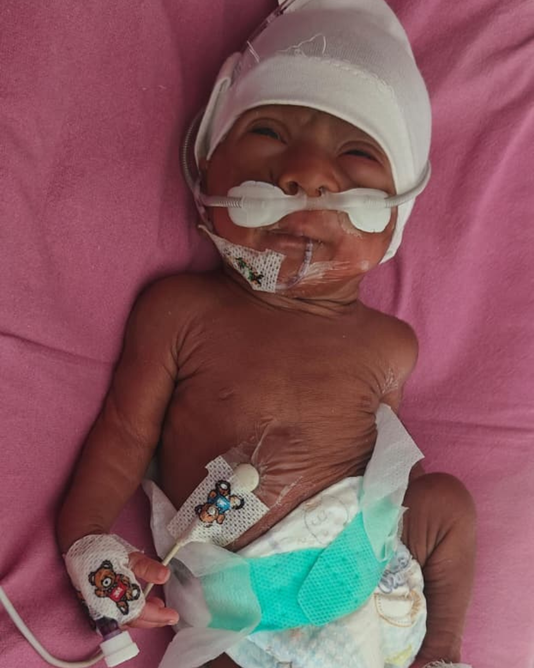 Save the Miracle Baby of Shashi and Rekhpal