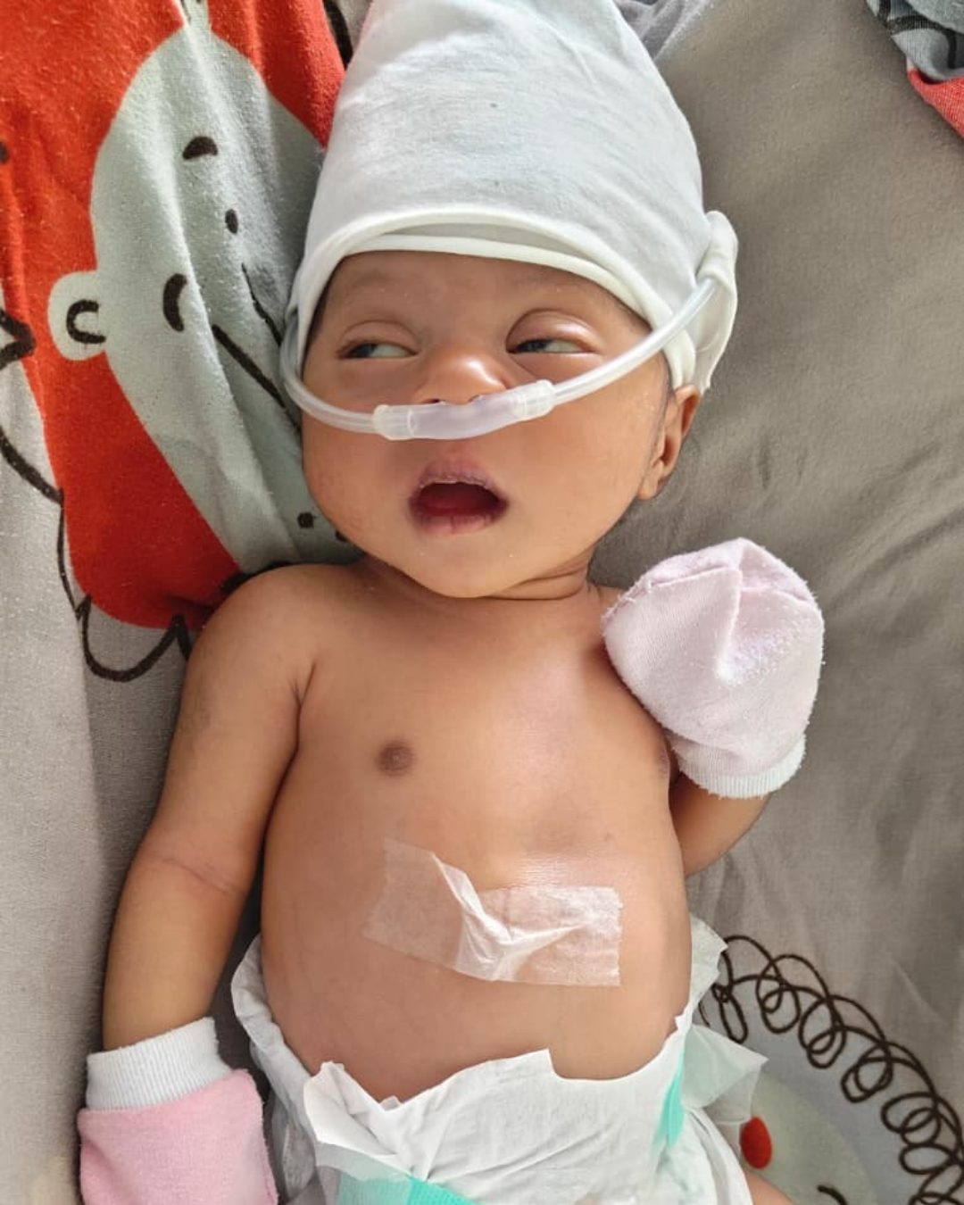 Baby of Ranjina is only 25 days old, yet she is already fighting for her life.