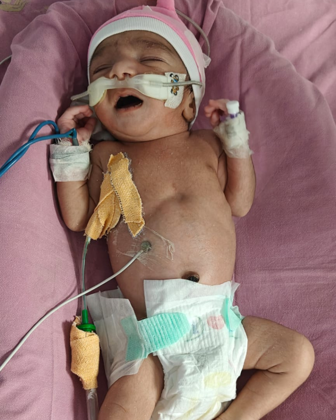 Help Save Baby of Sweety