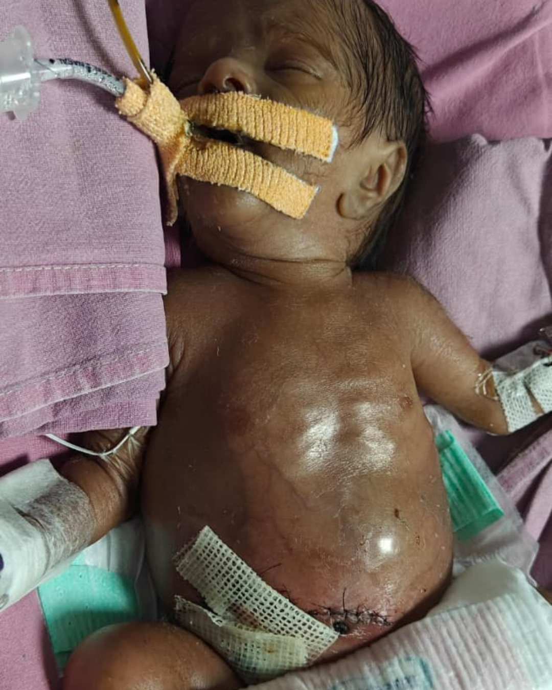 Baby of Sandhya